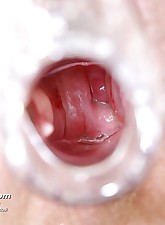 10 of 15