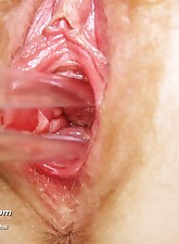 5 of 15